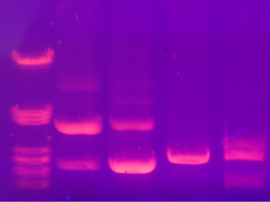 06_gel_elettroforesi.jpg